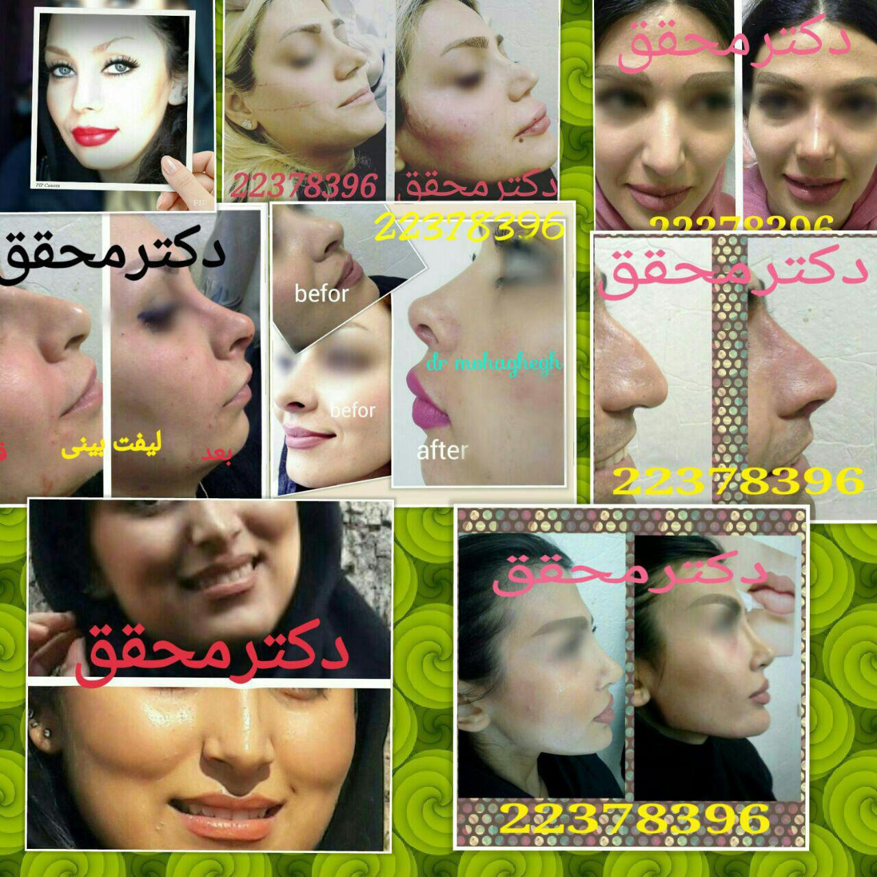 کانال تلگرام مطب زیبایی چهره سازان